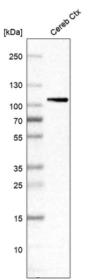 Western blot analysis in human cerebral cortex tissue.