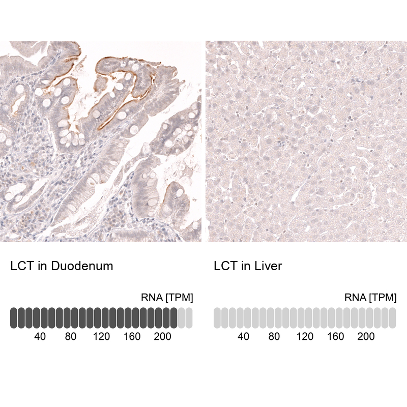 Anti-LCT Antibody