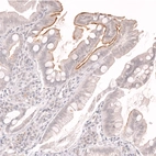 Immunohistochemical staining of human duodenum shows moderate membranous positivity in the intestinal brush border.
