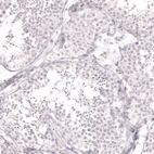 Immunohistochemical staining of human testis shows no positivity in cells in seminiferous ducts as expected.