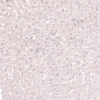 Immunohistochemical staining of human liver shows no positivity in hepatocytes as expected.