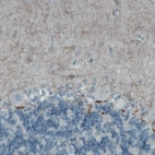Immunohistochemical staining of human cerebellum shows moderate positivity in neuropil of the molecular layer.