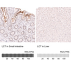 Anti-LCT Antibody