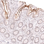 Immunohistochemical staining of human small intestine shows strong membranous positivity in the intestinal brush border.