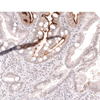 Immunohistochemical staining of human duodenum shows strong membranous positivity in the intestinal brush border.