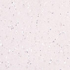 Immunohistochemical staining of human cerebral cortex shows no positivity in neurons as expected.