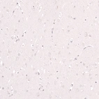 Immunohistochemical staining of human cerebral cortex shows no positivity in neurons as expected.