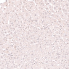 Immunohistochemical staining of human liver shows no positivity in hepatocytes as expected.