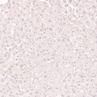 Immunohistochemical staining of human liver shows no positivity in hepatocytes as expected.