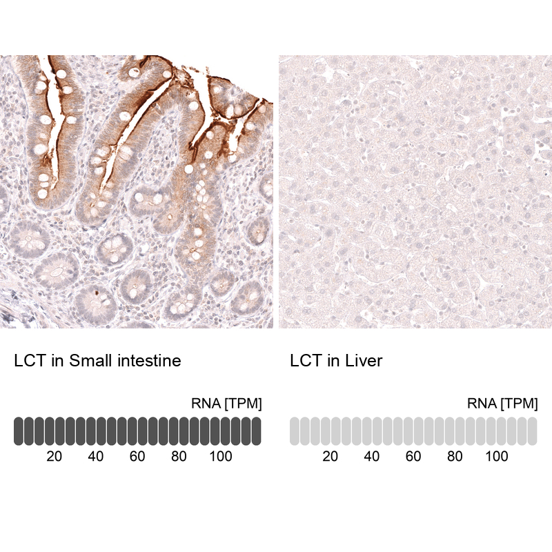 Anti-LCT Antibody