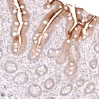 Immunohistochemical staining of human small intestine shows strong membranous positivity in the intestinal brush border.