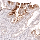 Immunohistochemical staining of human duodenum shows strong membranous positivity in the intestinal brush border.