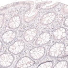 Immunohistochemical staining of human colon shows no positivity in glandular cells as expected.