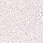 Immunohistochemical staining of human liver shows no positivity in hepatocytes as expected.