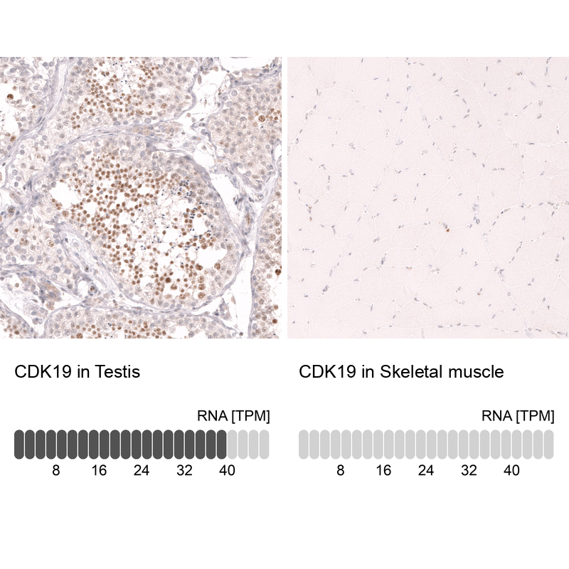 Anti-CDK19 Antibody