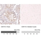 Anti-CDK19 Antibody