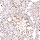 Immunohistochemical staining of human testis shows strong nuclear positivity in spermatids.