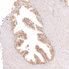 Immunohistochemical staining of human prostate shows moderate nuclear positivity in glandular cells.