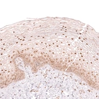 Immunohistochemical staining of human cervix shows moderate nuclear positivity in squamous epithelial cells.