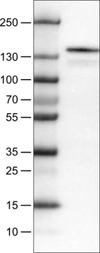 Lane 1: Marker [kDa]_br/_Lane 2: Human cell line RT-4