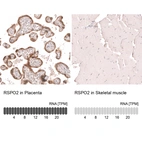 Anti-RSPO2 Antibody
