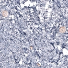 Immunohistochemical staining of human ovary shows weak to moderate cytoplasmic positivity in oocytes.