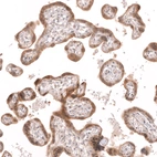 Immunohistochemical staining of human placenta shows moderate cytoplasmic positivity in trophoblastic cells.