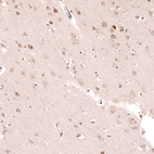 Immunohistochemical staining of human cerebral cortex shows weak to moderate cytoplasmic positivity in neurons.
