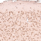 Immunohistochemical staining of mouse brain shows moderate to strong cytoplasmic positivity in neurons.