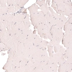 Immunohistochemical staining of human skeletal muscle shows no positivity in myocytes as expected.