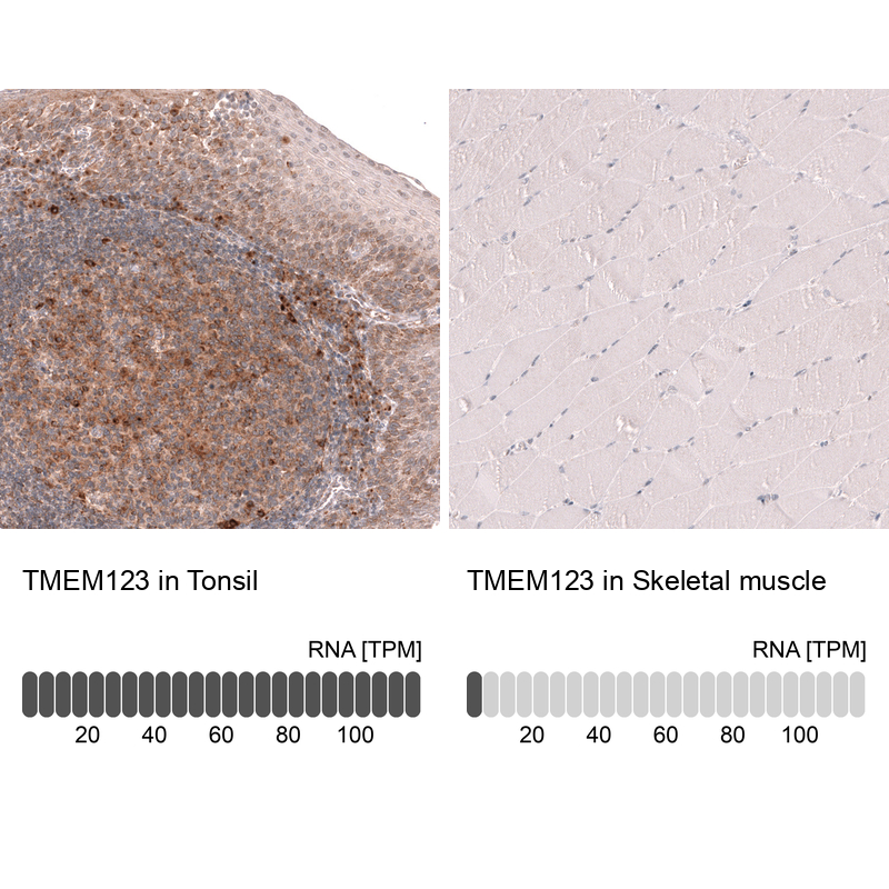 Anti-TMEM123 Antibody