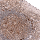 Immunohistochemical staining of human tonsil shows moderate to strong cytoplasmic positivity in germinal center cells.