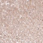 Immunohistochemical staining of human liver shows moderate cytoplasmic positivity in hepatocytes.