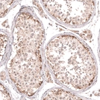 Immunohistochemical staining of human testis shows moderate to strong cytoplasmic positivity in cells in seminiferous ducts.