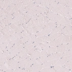 Immunohistochemical staining of human skeletal muscle shows no positivity in myocytes as expected.