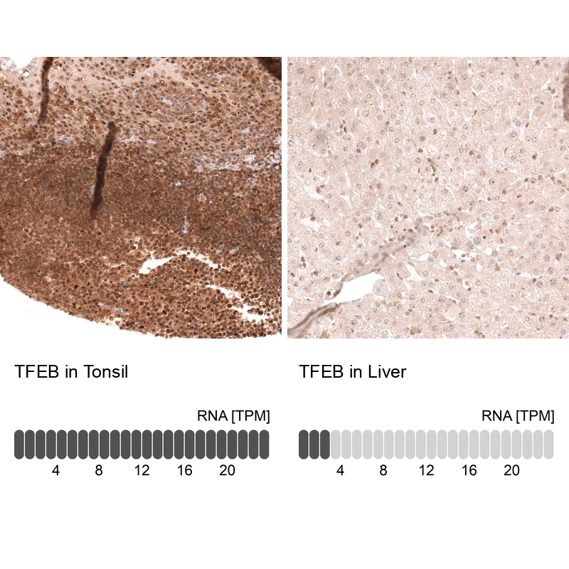 Mouse Monoclonal Anti-TFEB Antibody - Buy for research - Highly ...