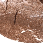 Immunohistochemical staining of human tonsil shows strong nuclear and cytoplasmic positivity in non-germinal center cells.