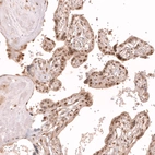 Immunohistochemical staining of human placenta shows strong nuclear positivity in trophoblastic cells.