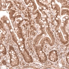 Immunohistochemical staining of human small intestine shows strong nuclear positivity in glandular cells.
