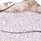 Immunohistochemical staining of human cervix shows strong nuclear positivity in squamous epithelial cells.