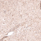 Immunohistochemical staining of human liver shows very weak positivity in hepatocytes.