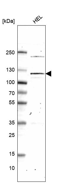 Anti-PMS1 Antibody