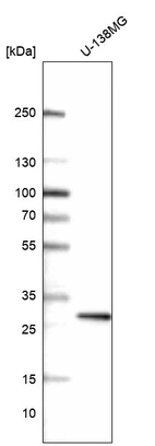 Anti-PRRX1 Antibody