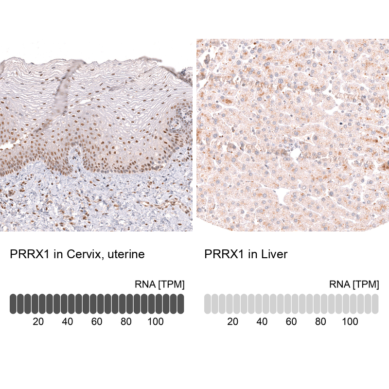 Anti-PRRX1 Antibody