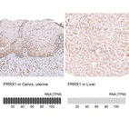 Anti-PRRX1 Antibody