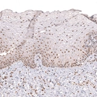 Immunohistochemical staining of human uterine cervix shows strong nuclear positivity in squamous epithelial cells.