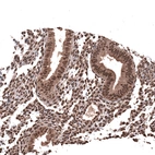 Immunohistochemical staining of human endometrium shows strong nuclear positivity in glandular cells.