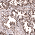 Immunohistochemical staining of human prostate shows strong nuclear positivity in glandular cells.
