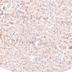 Immunohistochemical staining of human liver shows no nuclear positivity in hepatocytes as expected.