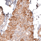 Anti-CMPK2 Antibody